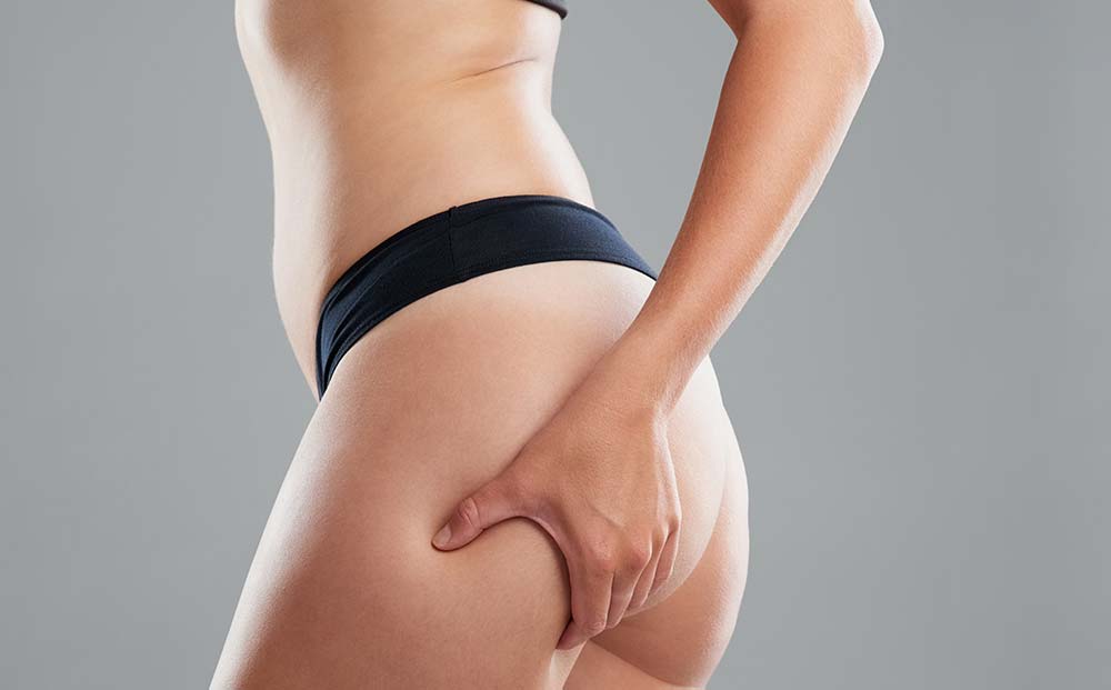 Touching Butt | Cellulite Treatment | Dr. Nikolov