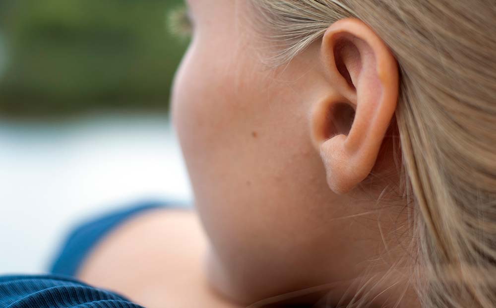Photo of Ear | Otoplasty | Dr. Nikolov
